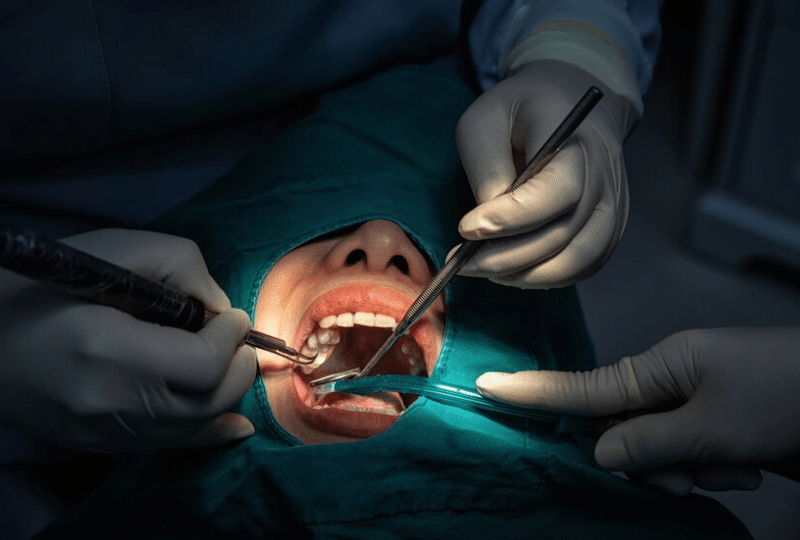 Oral Surgery in East York, ON