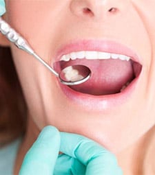 Dental Checkups - General Dentist in East York, ON