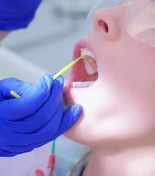Fluoride Treatment - General Dentist in East York, ON