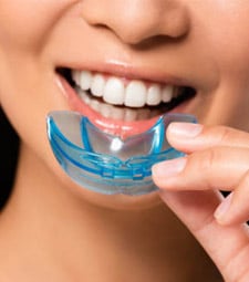 Mouth Guards - General Dentist in East York, ON
